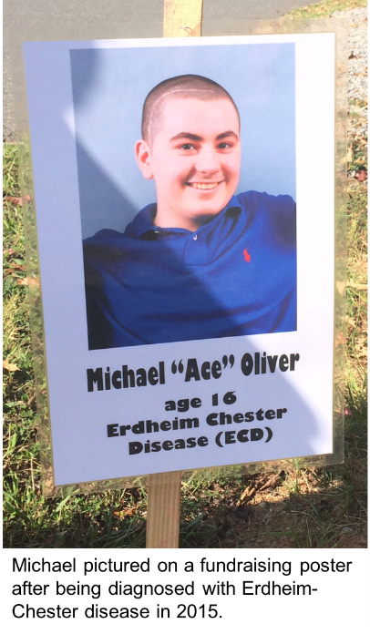 Το αγόρι με Erdheim-Chester Disease
