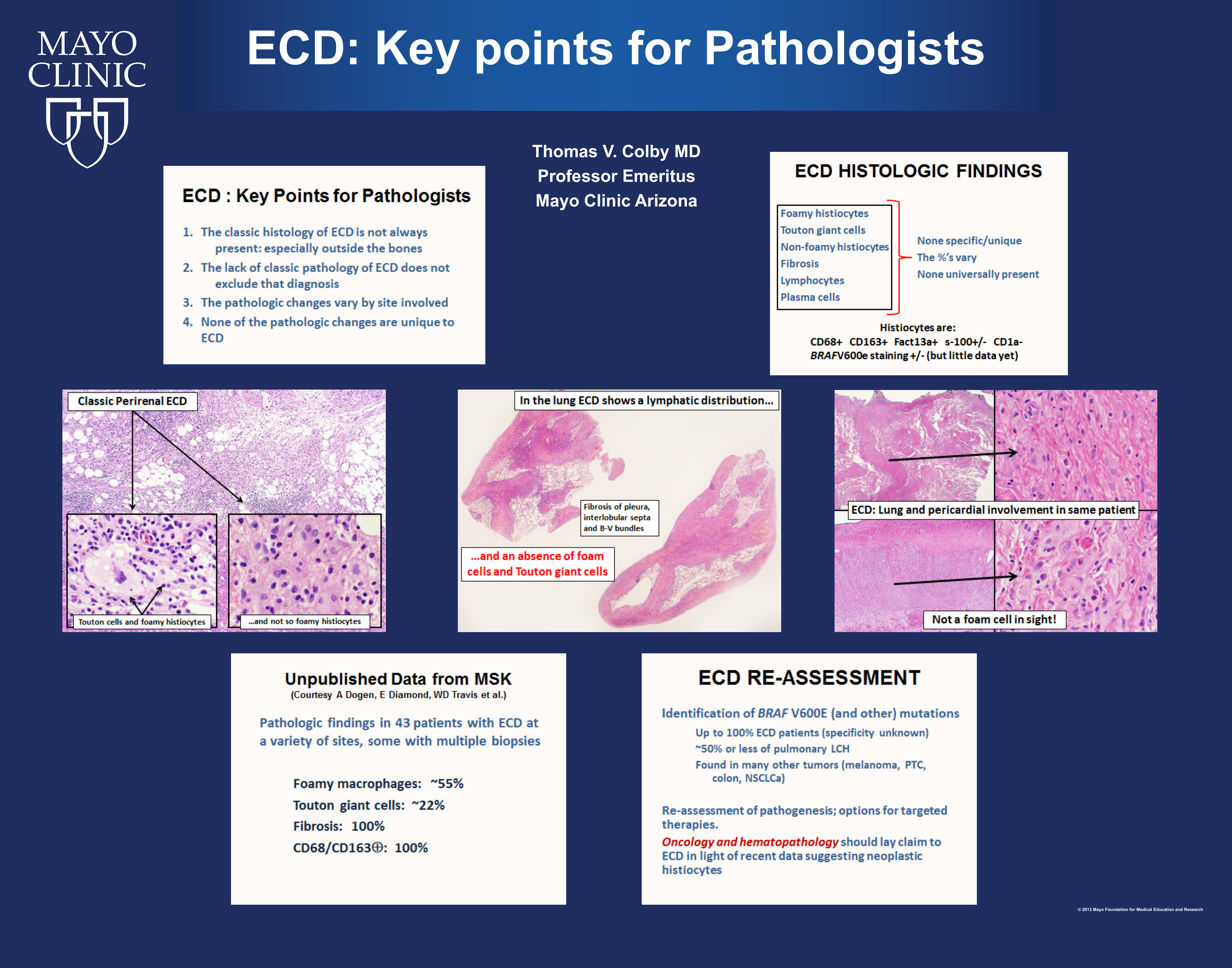 TVColby_Key-Points_ECD-Poster_22x28-1