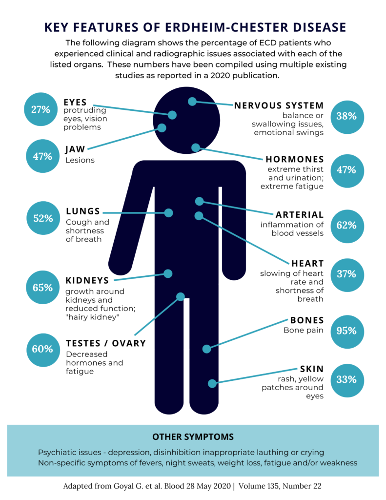 Reconhecendo Erdheim-Chester doença precocemente: Por que a conscientização é importante