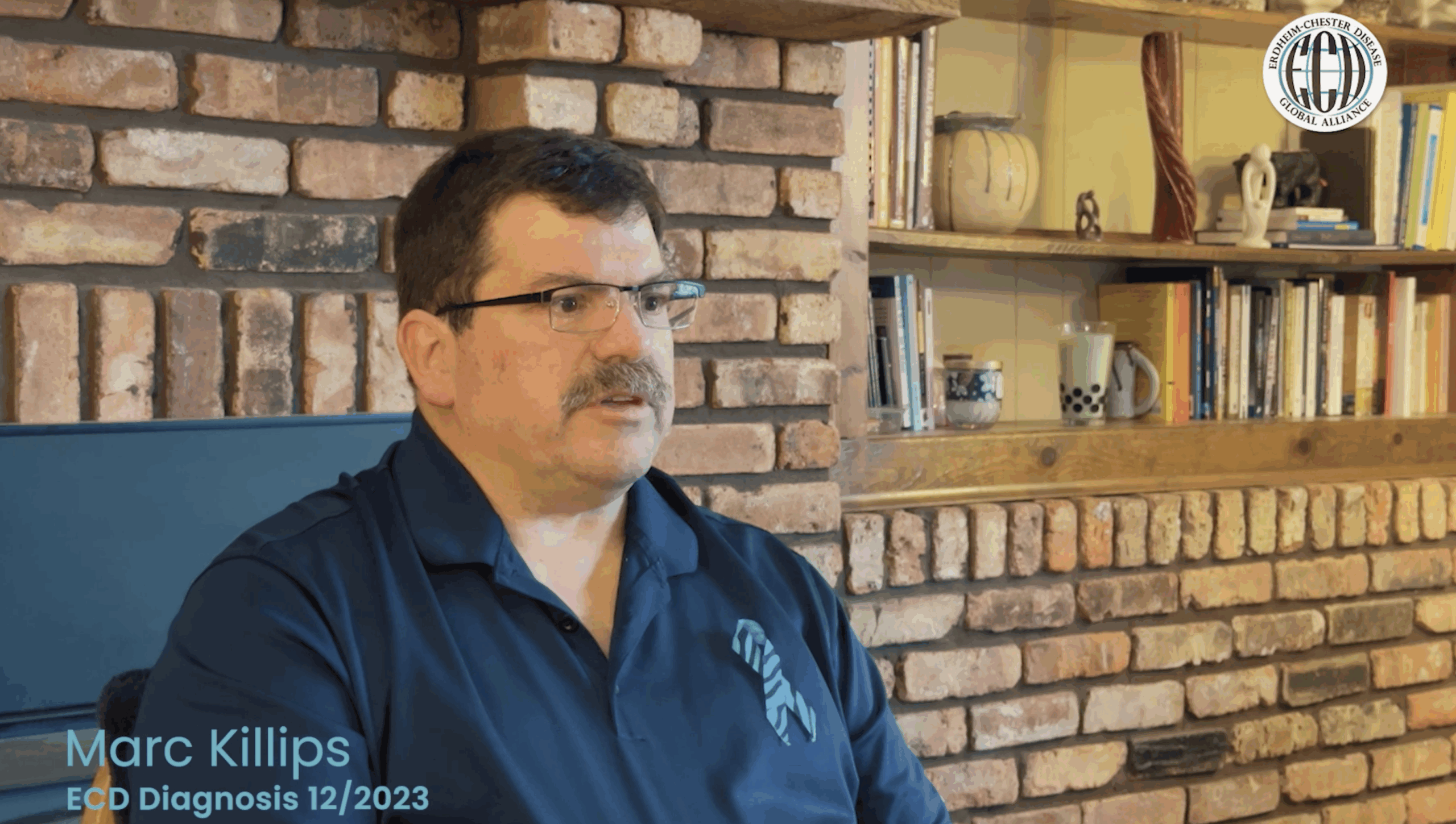 Por que o diagnóstico precoce é importante em Erdheim-Chester doença: A história de Marc