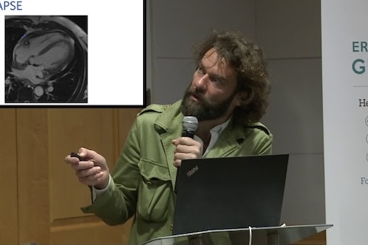 Destaque da sessão: ECD Opções de tratamento – atuais e futuras