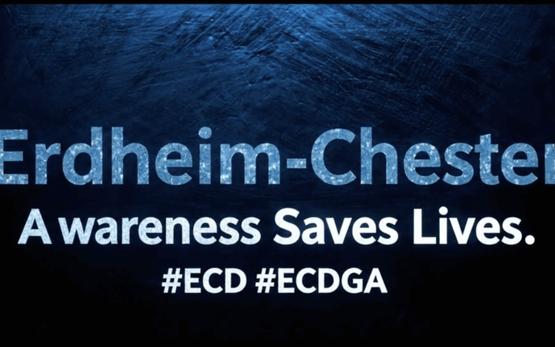 Have you heard? It’s ECD Awareness Week! Ziggy the Zebra is spreading the word.